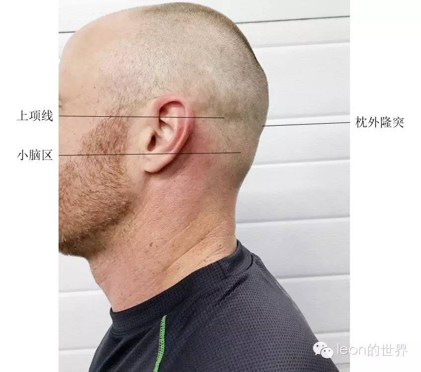 枕外隆突和上项线以下是小脑的位置后颅窝的体表定位点———枕外隆突