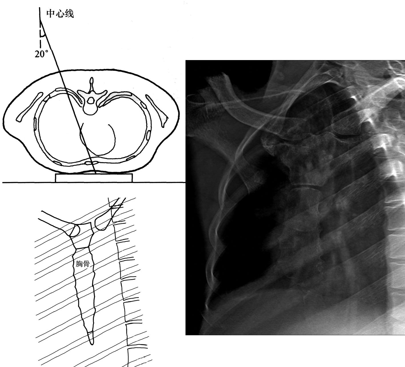 胸部x线摄影体位及临床意义