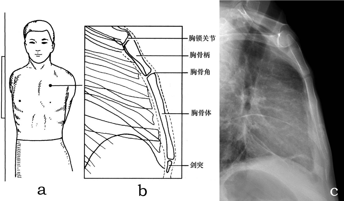 胸部x线摄影体位及临床意义
