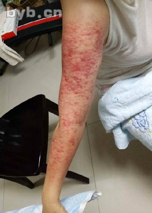 点按身体经络穴位时会经常打嗝放屁说明你属于经络敏感型