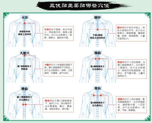 特别说明:三伏贴贴敷的适应症主要有:支气管哮喘,慢性支气管炎,肺气肿