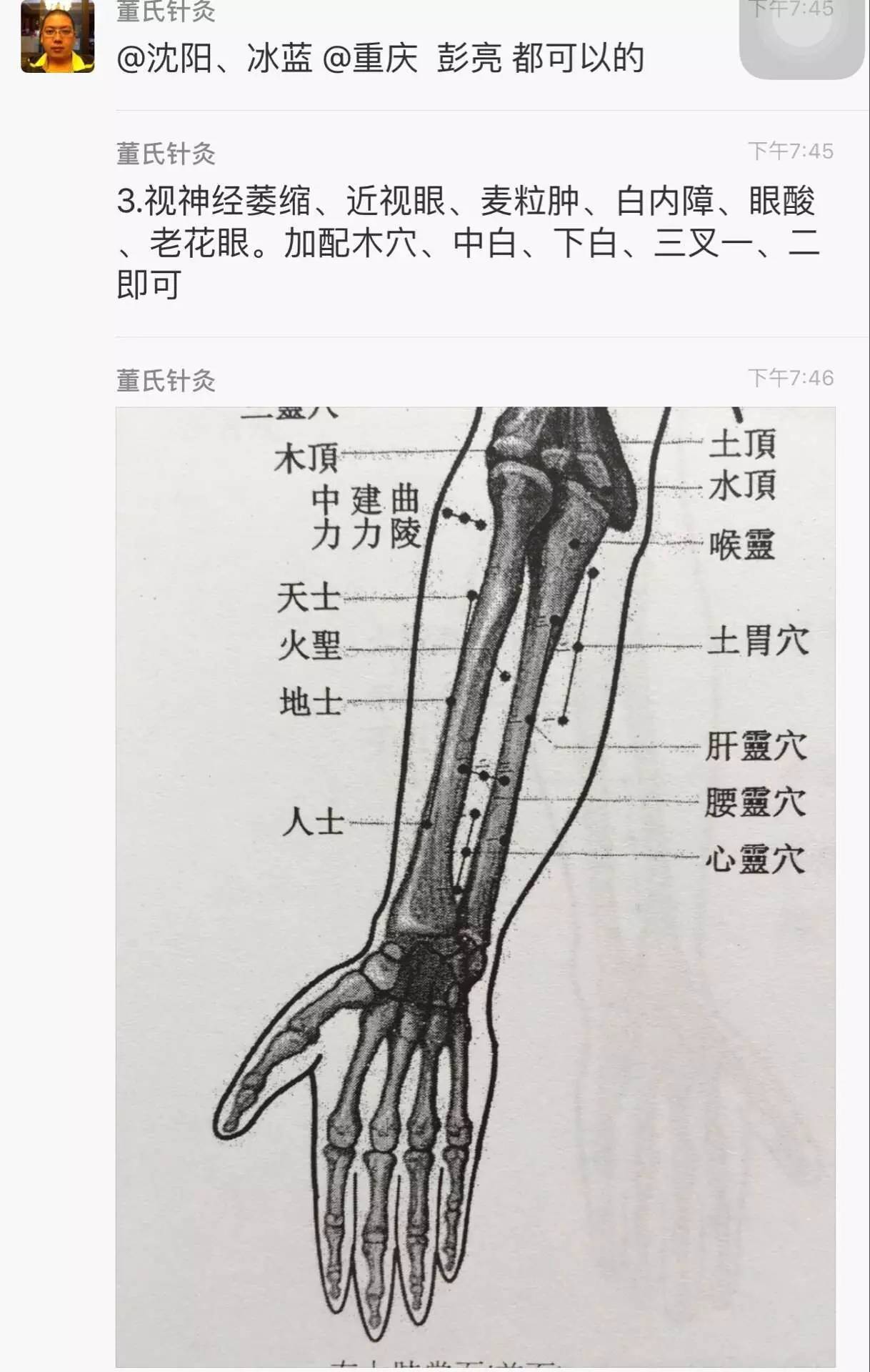 董氏针灸三顶定位图片图片