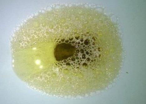 尿酸铵结晶尿图片图片