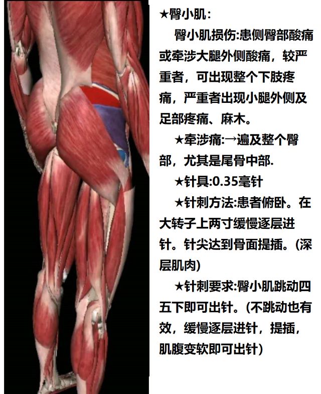 髋外旋肌群有哪些肌肉图片