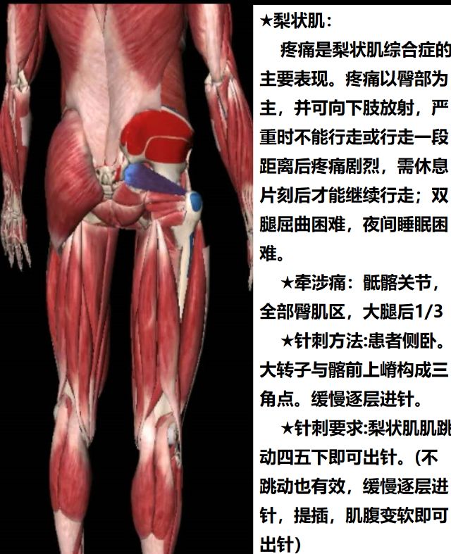 髋外旋肌群有哪些肌肉图片