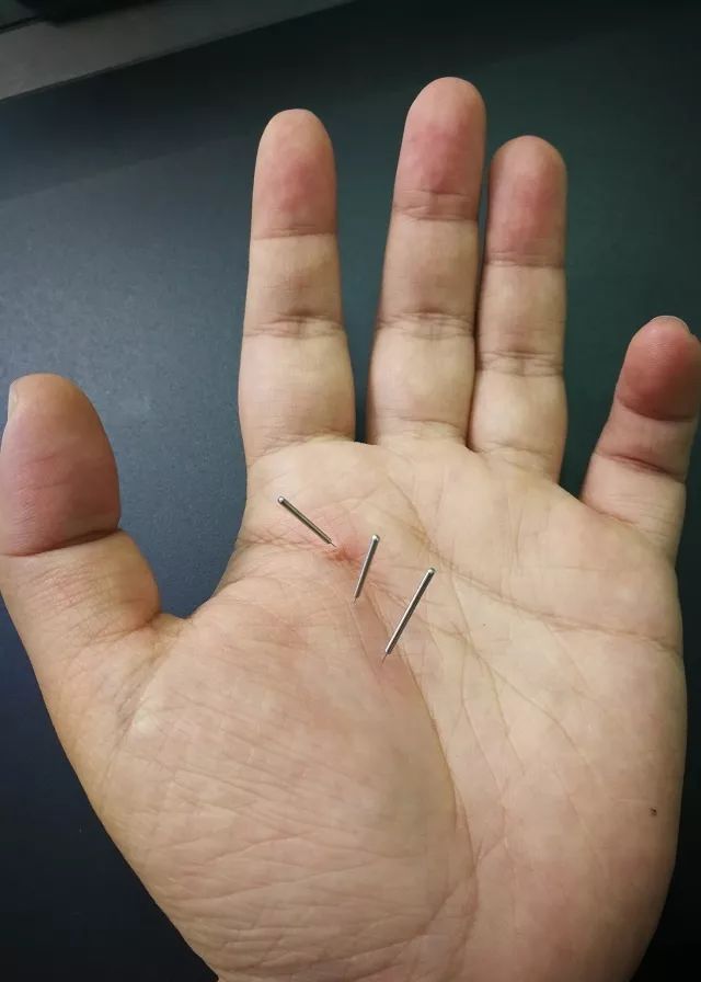 三毛手掌上的四花穴董氏针灸穴位解读