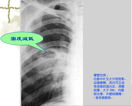 x线双房影图片图片