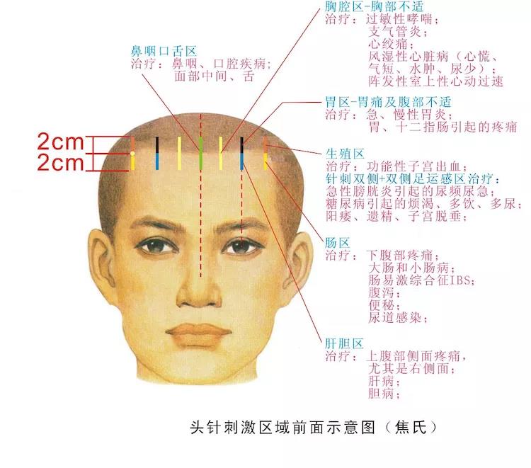 焦氏头针之  天龙八步 (附手机屏保图片)