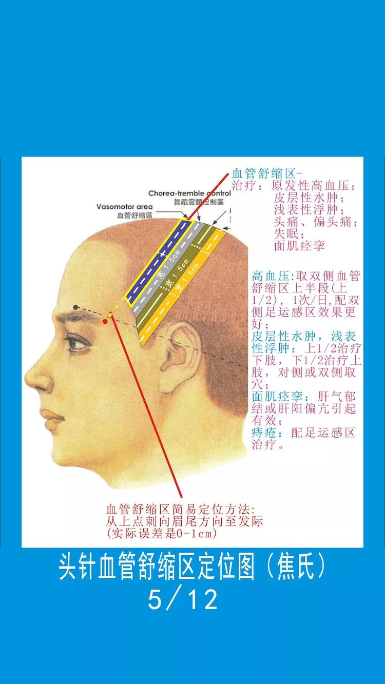 头皮针言语一区位置图图片