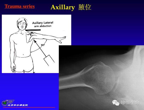 肩关节x线检查体位大全