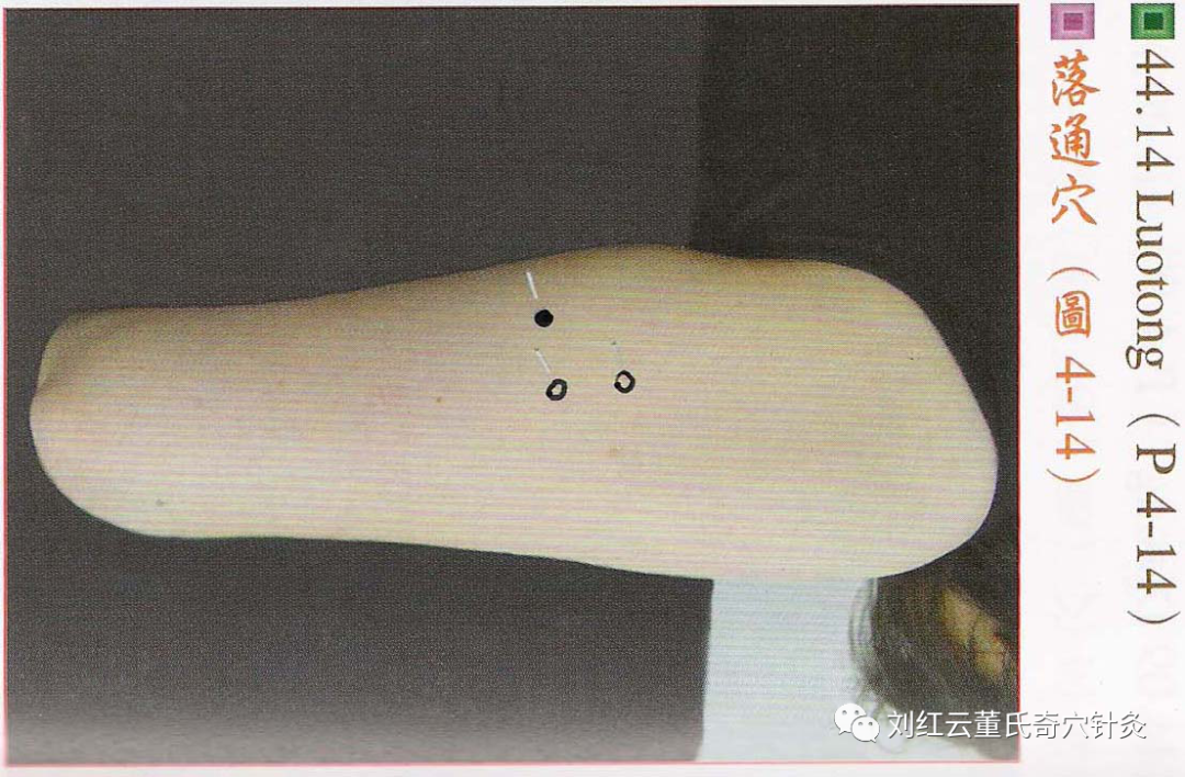 【下曲穴】主治:血压高,坐骨神经痛(肺与肝两种机能不健全所引起者.