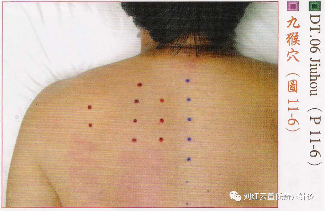 董氏奇穴十一部分后背部穴位详解收藏版带高清大图